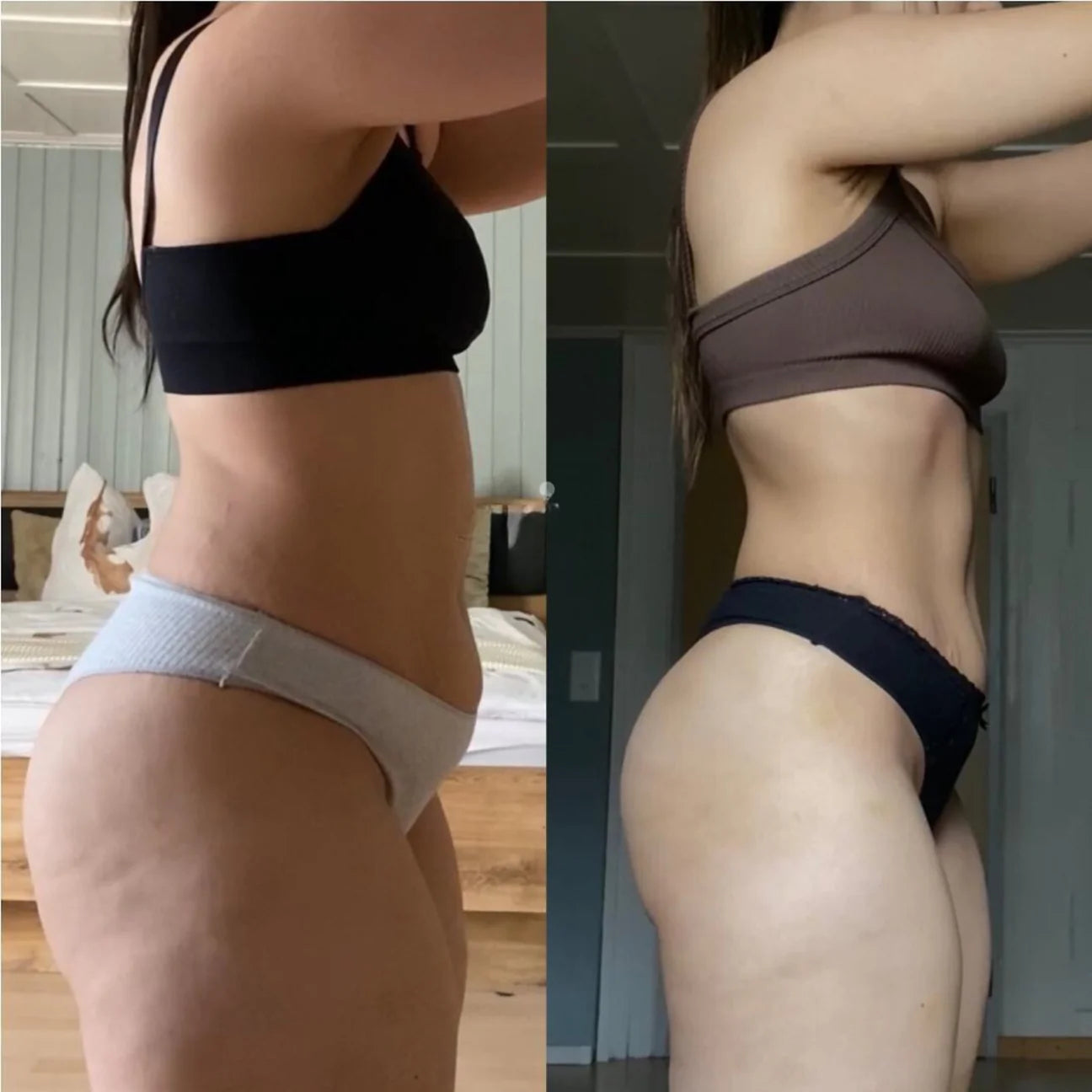 Doğal İçerikli Bölgesel İncelme ve Ödem Attırıcı Zayıflama Bandı